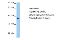 GNB1L Rabbit anti-Human, Polyclonal, Novus Biologicals 0.1ml; Unconjugated:Antibodies,